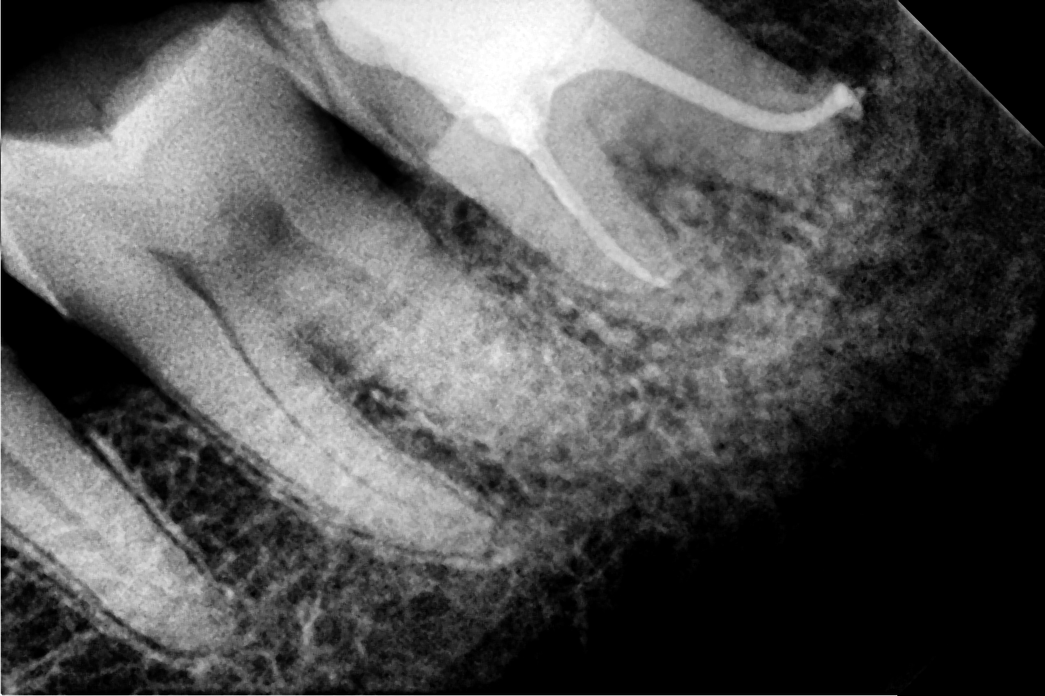 After Treatment