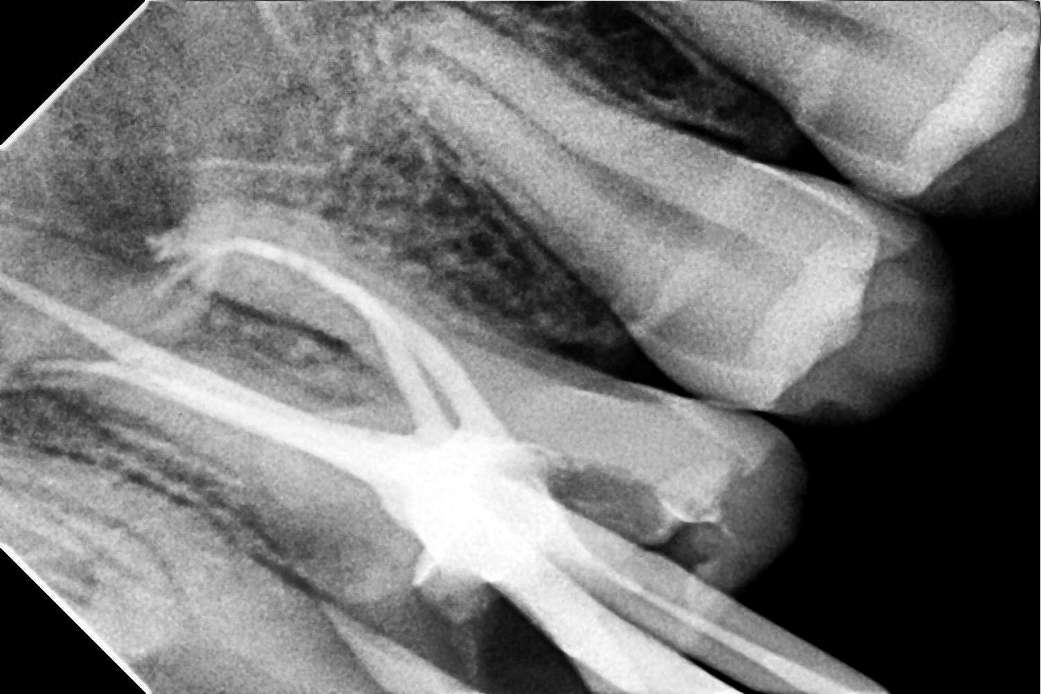 Before Treatment