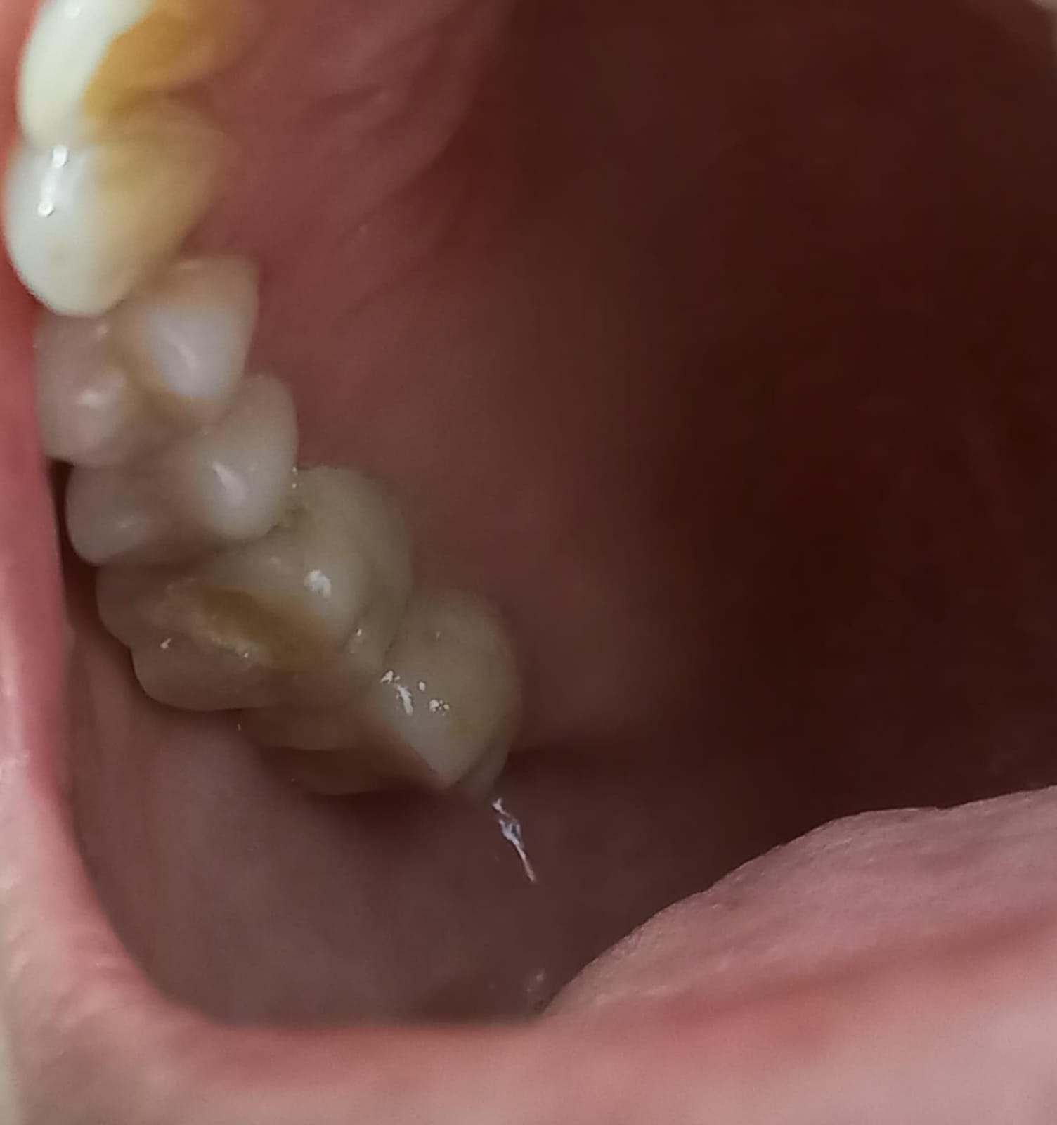 After Treatment