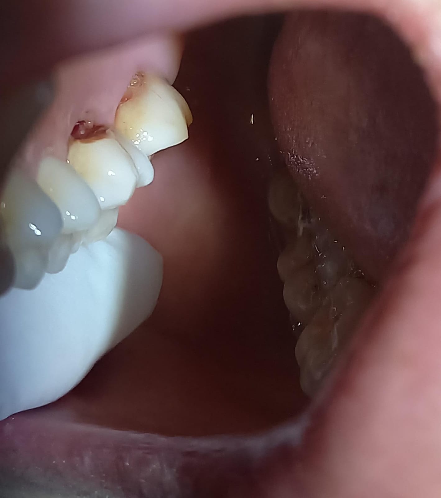 After Treatment