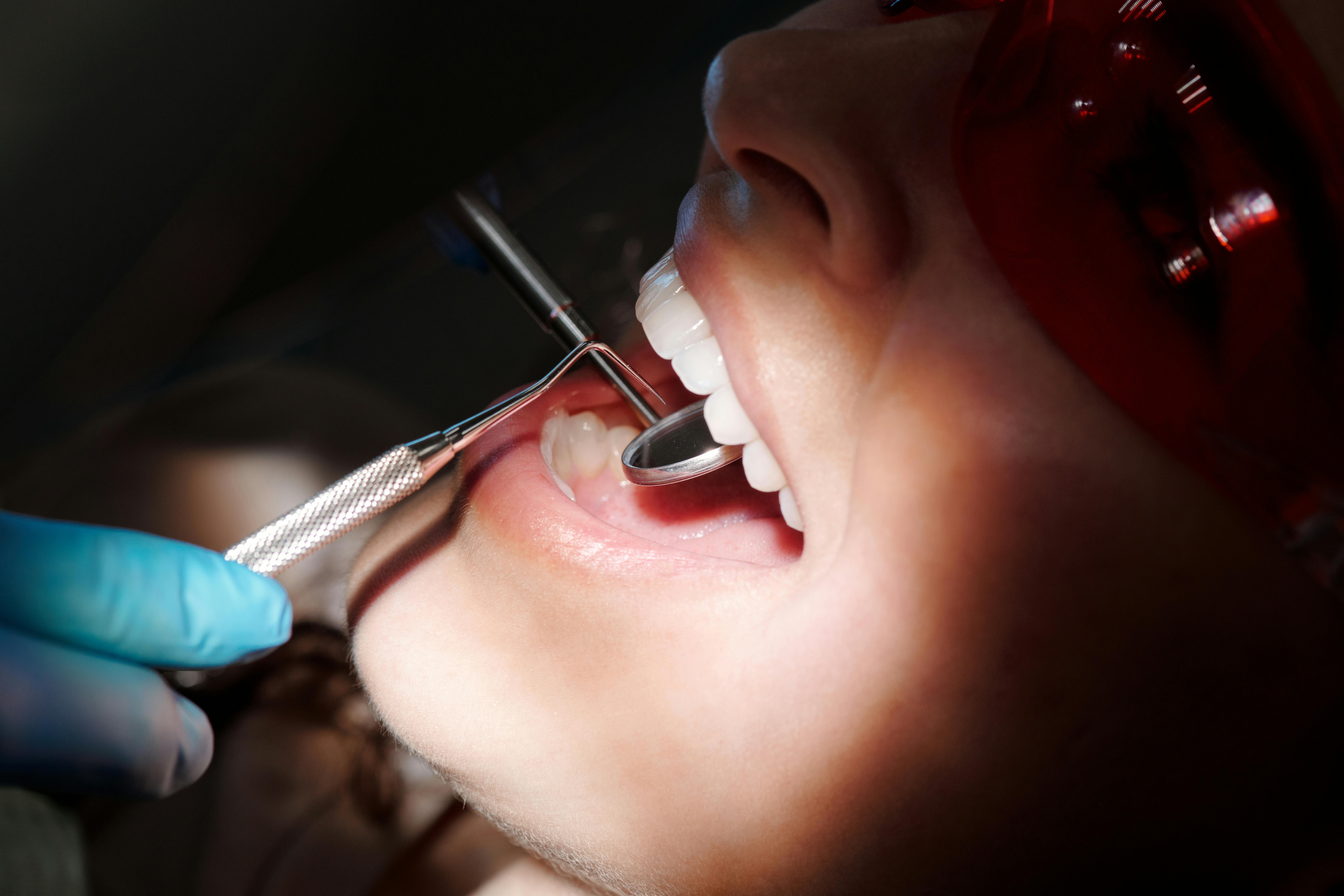 Teeth Cleaning