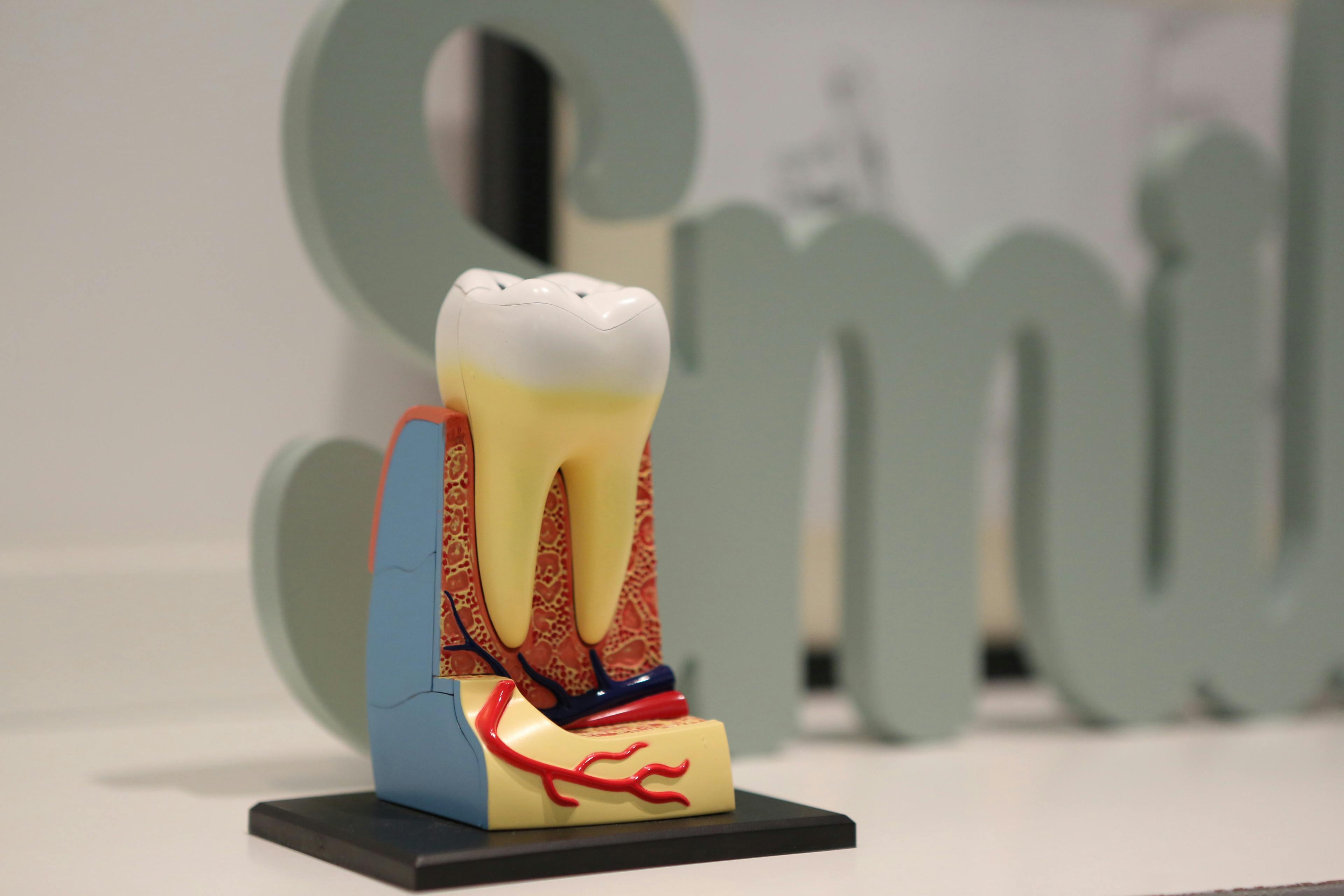 Root Canal Treatment